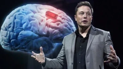 Elon Musk's Brain Chip Start Up About To Start Human Trials