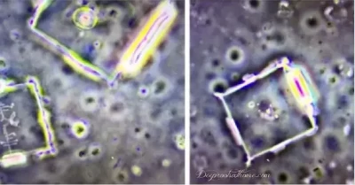 Scientists Find Graphene & Nanotechnology In Dental Anesthetics