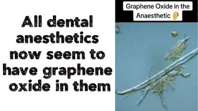 All dental anesthetics now seem to have graphene oxide in them - Watch