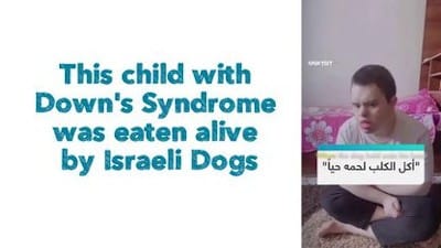 This child with Down Syndrome was eaten alive by Israeli Dogs - Watch