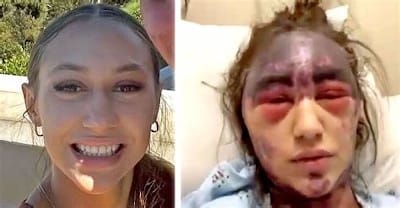 Woman Suffers HORRIFIC Injuries After Receiving Meningitis, Pneumonia & Tetanus Vaccines AT THE SAME TIME! - Watch