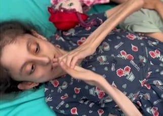 Hunger is devouring the bodies of Palestinians in Gaza - Watch