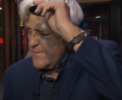 Jay Leno Gets Swollen Eye After Falling Down 60-Foot Hill - Watch