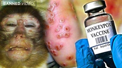 REPORT: How Monkeypox Was Planned For Pandemic