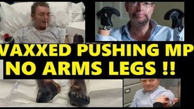 Vax MP No Arms Or Legs, Cut Off!! - Watch