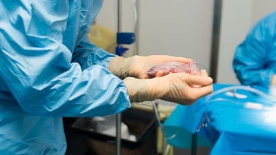 Surgeons Achieve 'Groundbreaking' Pig-to-Human Kidney Transplant